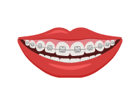 Braces