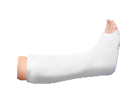 Broken Leg