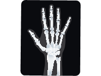 X Ray Of A Hand