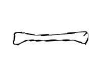 Bone 1